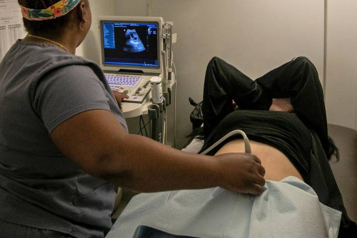 Number of abortions in Ohio slightly dropped in 2024, state data finds