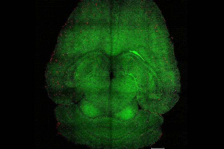 Científicos revierten el alzhéimer con nanopartículas a través del sistema vascular