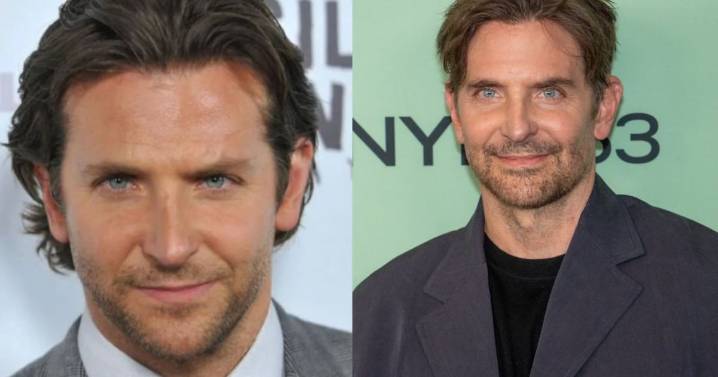 Rellenos, Facelift y Blefaroplastia: Los Procedimientos que Atribuyen a Bradley Cooper tras su Nuevo Rostro