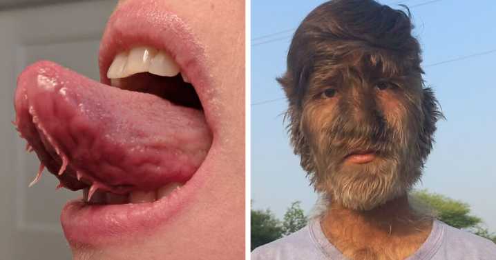 74 People Share Rare And Surprising Things About Their Bodies (New Pics)