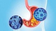 A healthier gut may help improve depression and anxiety: Study