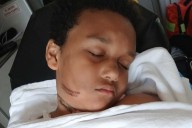Boy Burned When Tablet Charger Got Caught in Metal Necklace, Mom Says (Exclusive)
