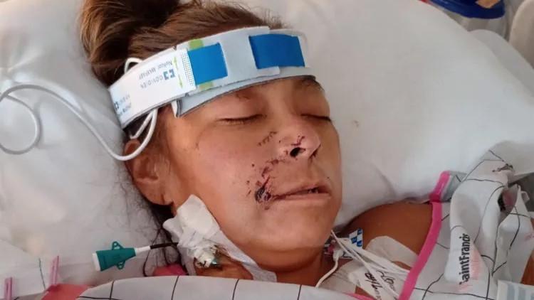 Oklahoma dog attack: Janelle Scott has all four limbs amputated after vicious mauling in US