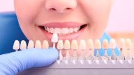 Dientes manchados: los alimentos que opacan tu sonrisa y cómo proteger el esmalte