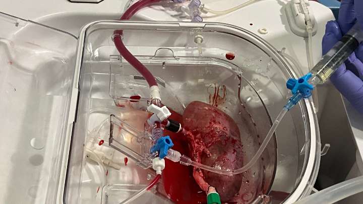 Una investigación abre las puertas a la reparación de órganos y a su recuperación para ser trasplantados