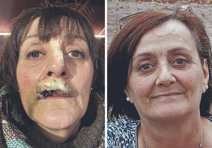 «Un perro me arrancó la boca y me está arruinando la vida»