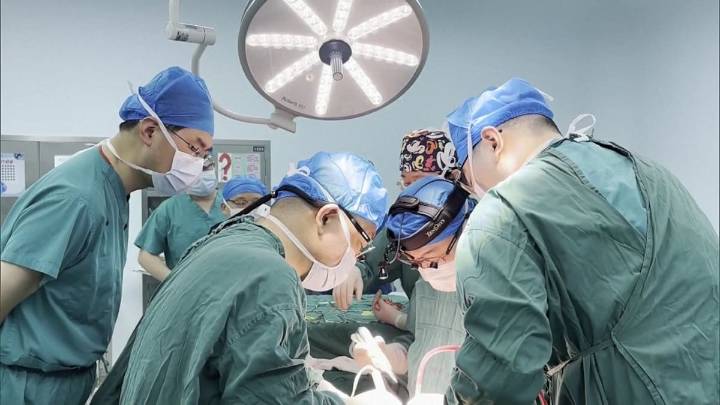 Avance científico. Trasplantan por primera vez a una persona viva un hígado de cerdo modificado genéticamente