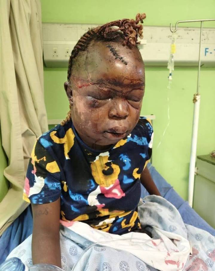 SAD|| South African woman beaten to pulp by her ex-boyfriend