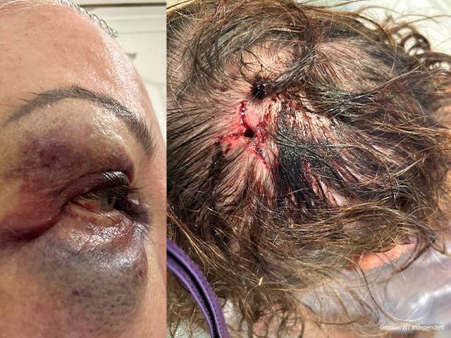 ‘He kicked the shit out of me’: Hostel manager tells of alleged assault by newly released prisoner