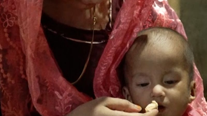 In the world’s largest refugee camp, Rohingya children are starving after USAID cuts