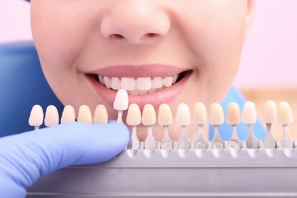 Los alimentos que más manchan los dientes y cómo cuidar el esmalte
