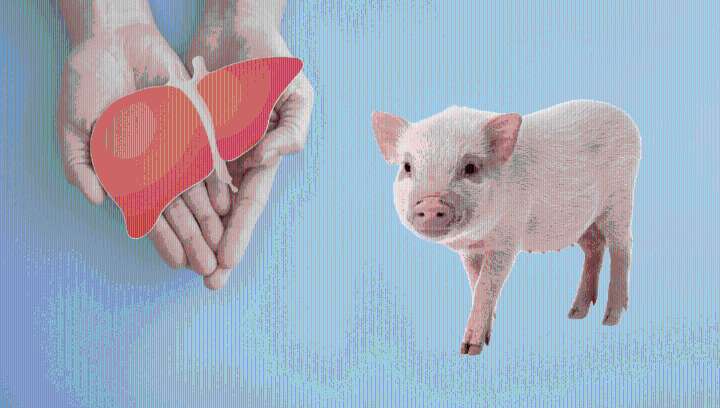 "A Historic Clinical Milestone": First-Ever Pig-To-Human Liver Transplant Performed On A Living Recipient