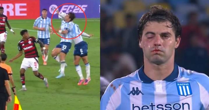 Video: Jugador se fractura la cara tras brutal golpe en pleno partido
