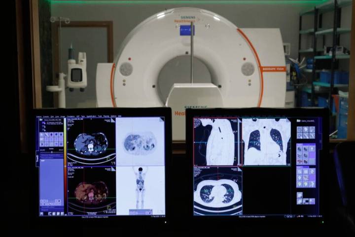 "Puede resumir 50 folios de estudios en cinco minutos": hablamos con los hospitales españoles que ya están utilizando la IA