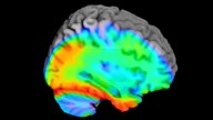 Opinion: Stigma around Alzheimer’s delays treatment in Latino community