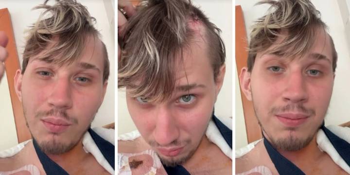 Cómo es el estado de salud de Brunenger después del fuerte accidente que sufrió en la Autopista Panamericana