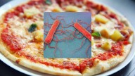 Listeria Outbreak: High-Risk Foods You Should Avoid Immediately
