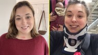 Mujer estuvo a punto de perder la vida al bostezar: "Me dieron un 50% de posibilidades de sobrevivir"
