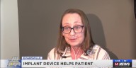 Medical implant offered by Ascension St. Vincent helps local woman avoid lung transplant