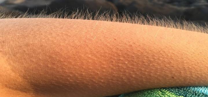 ¿Por qué se nos eriza la piel al escuchar una canción?