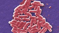Superbug surge: Drug-resistant bacteria threat grows in Detroit, U.S.