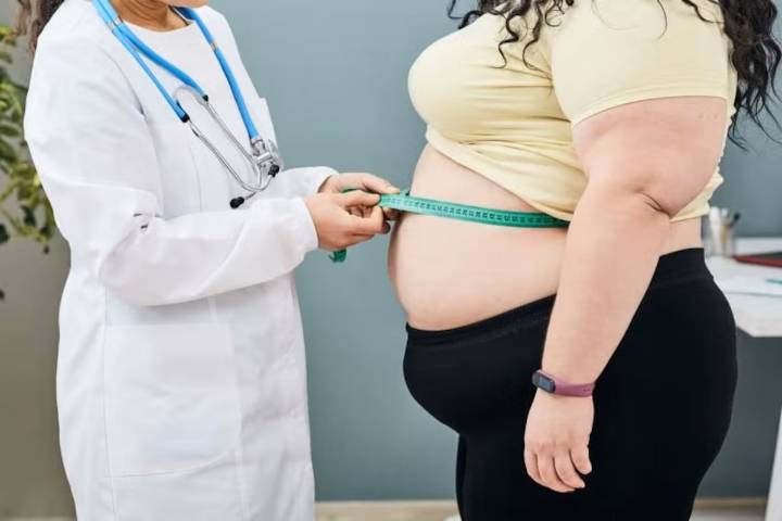 Obesidad, enfermedad crónica que requiere abordaje integral 