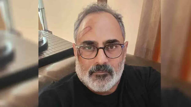 "So I learnt something today - with pain as a consequence": BJP state president Rajeev Chandrasekhar injured
