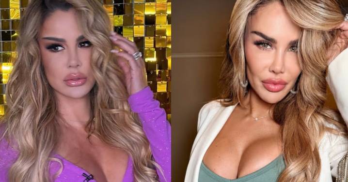 Ninel Conde se somete a cirugía para cambiar el color de sus ojos, ¿en qué consiste el procedimiento y cuánto cuesta?