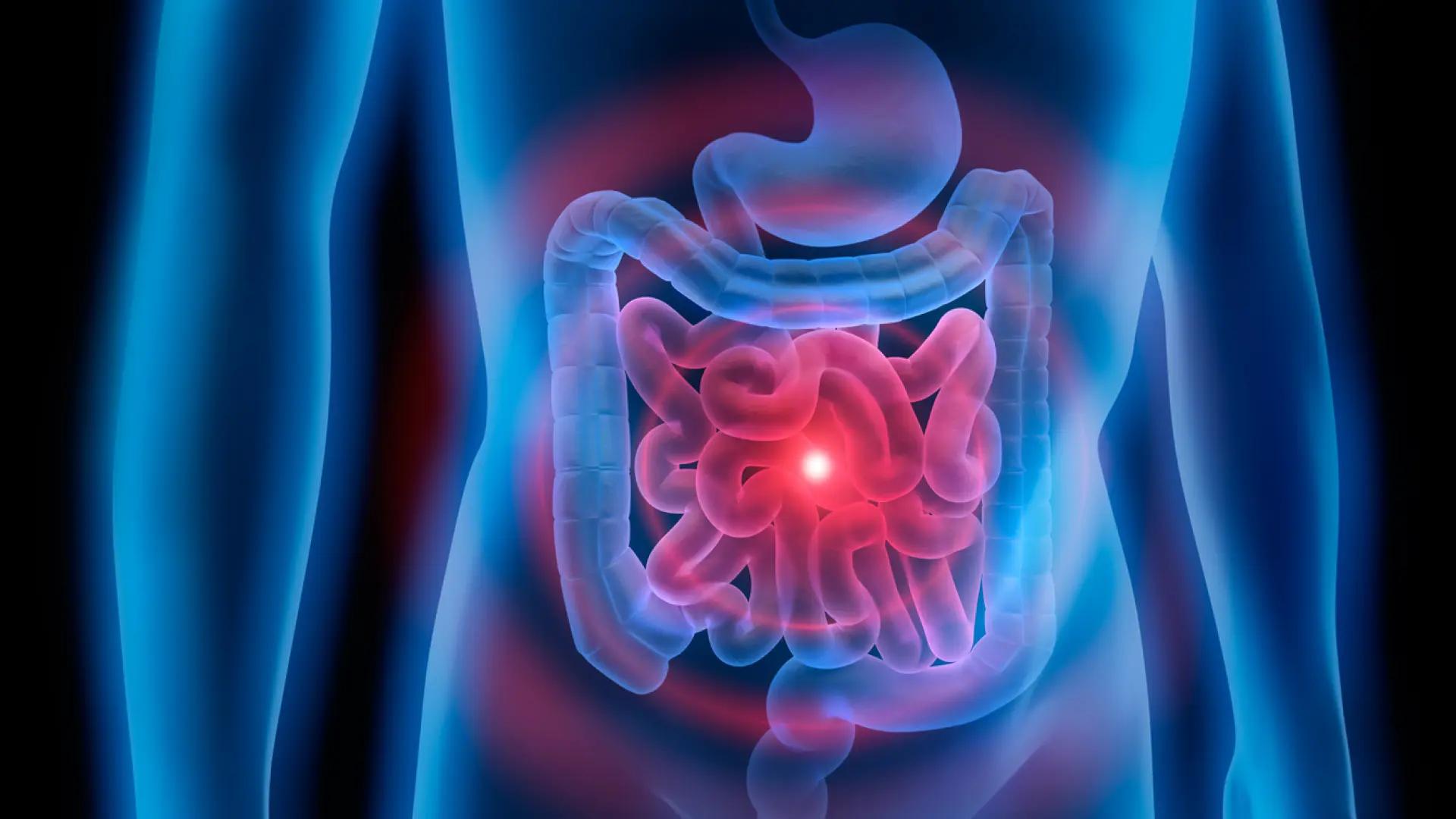¿Hay una epidemia de cáncer en adultos jóvenes? Un estudio pone en duda esa creencia... aunque hay una excepción