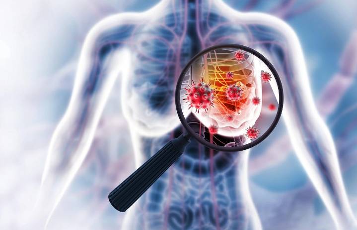 Incidence of Invasive Lobular Carcinoma Rose From 2012 to 2021