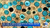 2nd case of severe mpox strain confirmed in LA County patient with no travel history, officials say