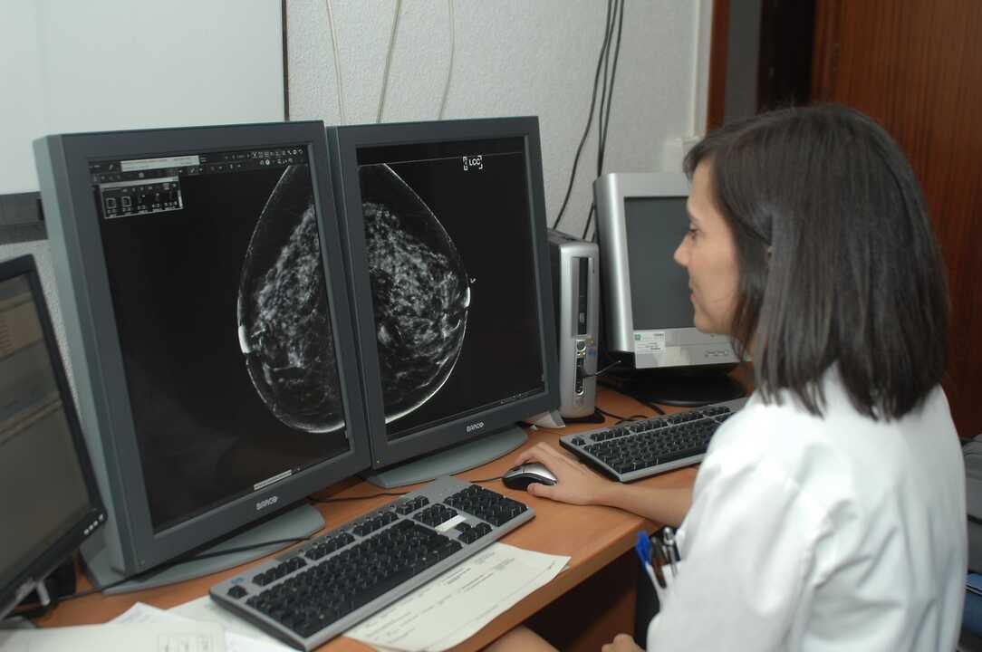 Por Andalucía demanda al SAS una revisión inmediata de los programas de cribado del cáncer de colon y cuello uterino