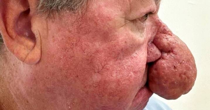 Granddad's conk was so big he couldn't smooch his misses