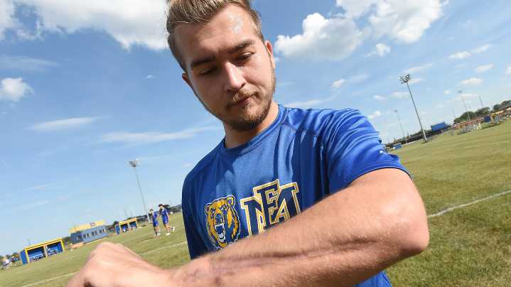 Surgery helps Smith return to soccer field after accident severed hand