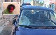 Hombre sufre desprendimiento de cuero cabelludo tras ser arrollado en calles de Motul