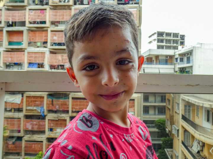 Orphaned by Israel, two child amputees find each other in Lebanon