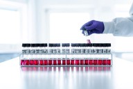 Nordic Capital-led consortium raises takeover price for Bavarian Nordic to $38.94 per share