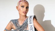 La mujer sin pelo que reescribió las reglas de la belleza en Miss Estados Unidos