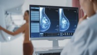 Cáncer de mama: cambian la edad en la que se debe hacer la primera mamografía en la provincia de Buenos Aires