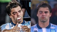 Preocupación en Racing: Santiago Sosa tiene fractura de maxilar por el golpe de Marcos Rojo y es duda para la revancha ante Flamengo