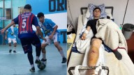 Operarán al jugador de futsal de Turdera que se accidentó: lograron juntar 2 millones de pesos