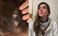 Korina Rivadeneira revela que gran parte de su cabello se cayó por dura crisis emocional: “Es dificilísimo salir”