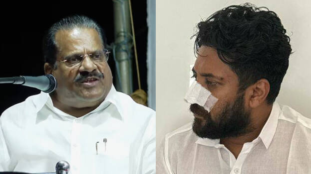 'Only nose injured now, be careful next time'; CPM leader EP Jayarajan takes sly dig at MP Shafi Parambil