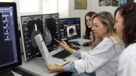 Crioablación en cáncer de mama en pacientes frágiles