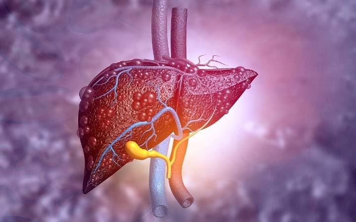 Tetrachloroethylene Tied to Risk for Significant Liver Fibrosis