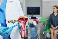 Chihuahua, pionero en reducción de miomas uterinos