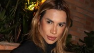 ¿Qué es y cuánto cuesta un Foxy eyes, que provocó la muerte del influencer Dutra Junior?