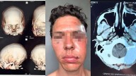 Termina dueño de taller automotriz en Puebla en el hospital tras reacción violenta de cliente