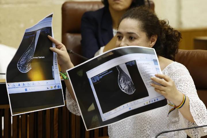 La Fiscalía de Andalucía abre diligencias sobre los fallos en el cribado del cáncer de mama en Andalucía