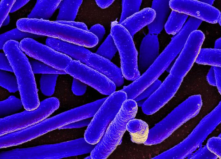 Contaminated Cheese From Washington Creamery Sickens People in Oregon and Washington